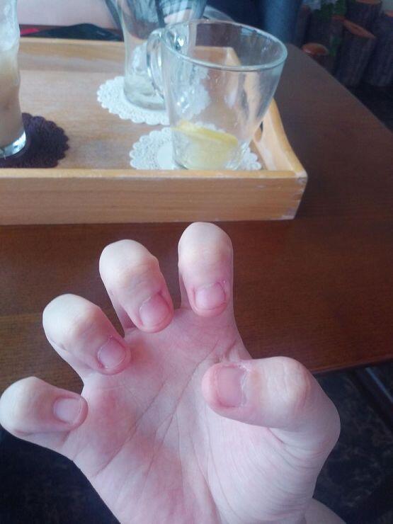 친구하고 친구동생하고 카페 갔었다 찍은 손톱 가끔 입으로 가져가긴 했는데 너무 짧아서 물어뜯을게 없었어