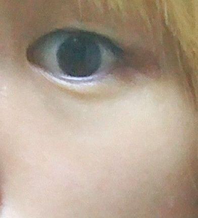 와 나 2번인데 답변달렸네 !! 고마버 스레주야!! 그런데 난 역시 이 한쪽눈의 어둑어둑한 눈물점이 컴플렉스인데... 이거 없애려면 뒤트임이랑