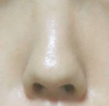 흠... 나 >>>8인데 내코가 딱 이렇거든...(?) 각각 옆면하고 정면이야... 스레주 힘들지 않았어...? 이뻐질려면 고통 받아야 할게 많