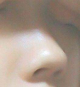 흠... 나 >>>8인데 내코가 딱 이렇거든...(?) 각각 옆면하고 정면이야... 스레주 힘들지 않았어...? 이뻐질려면 고통 받아야 할게 많