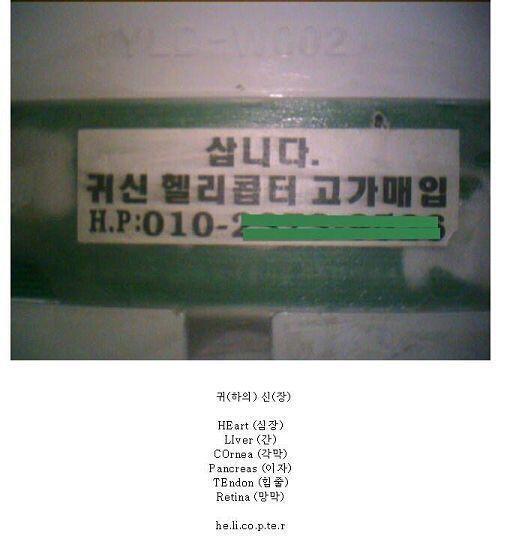 - 귀신 헬리콥터 많은 사람들이 장기매매로 추측하고 있지만 추측된 장기중 일부(폐, 망막)는 이식이 불가능하거나 자가이식(힘줄)하는게 훨씬 수지