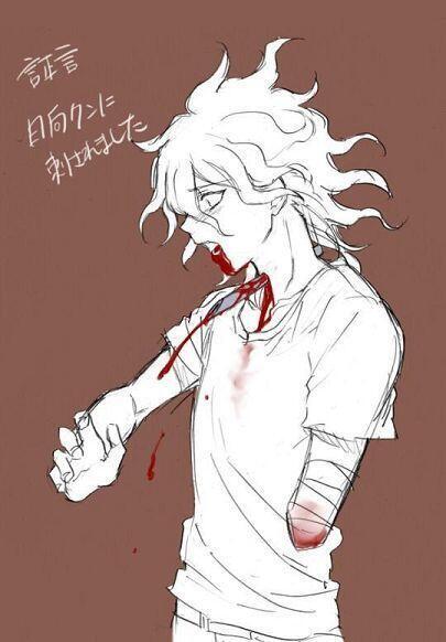 >>139 나머지 사진들.. 이것도 고어주의.