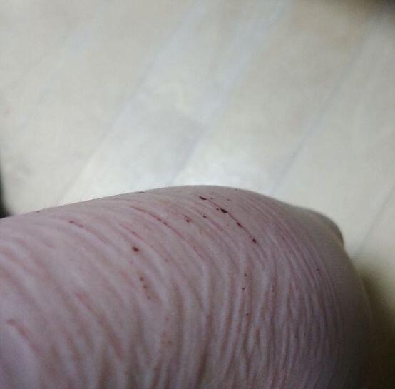 역시 자해는 피가 나와야 존잼인데 노잼쓰ㅠ 아니 씨발 칼날이 무뎌졌냐? 아니 씨발 뭘하면 무뎌져 ㅠㅠㅠ 귀찮아 진짜