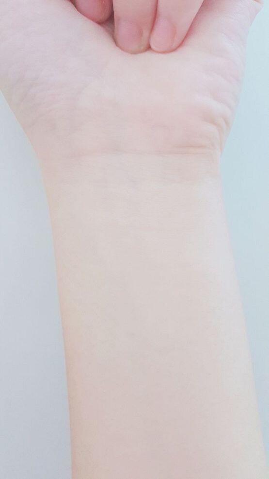 ㅍ..핏줄이 안보이는데....ㅠ