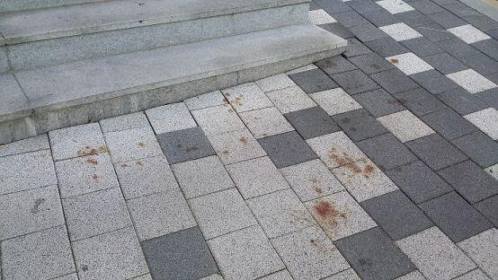 혹시 이거 피야?