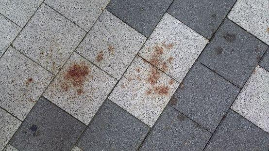 혹시 이거 피야?