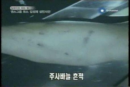 당시 매니저가 인터뷰한 사진과 김성재 시신에 있던 주삿바늘 흔적의 사진들이야! 조금 더 도움이 될까해서 첨부할게. 그리고 추가해 제판과 용의자였