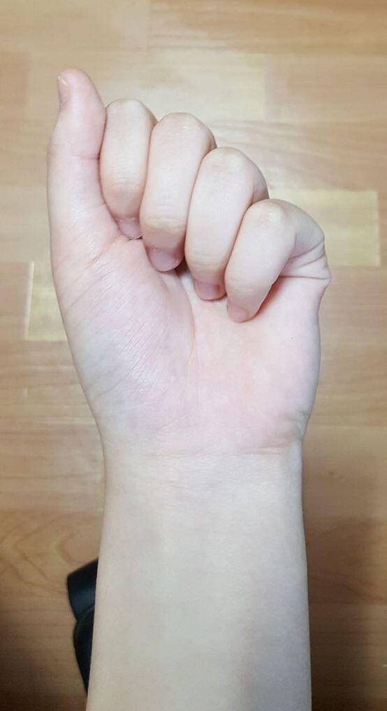 (족발주의)