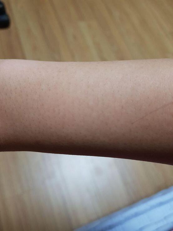 진짜 이거 어떻게 없애냐 ㅠㅠ