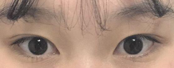 1 속쌍