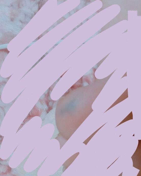 헉 나 오른발 엄지발가락에 이상한 거 있어! 스레주처럼 생긴 건 아니긴 한데... 진짜 기억도 안 나는 어릴 때부터 있었어 물어봐도 부모님도 모
