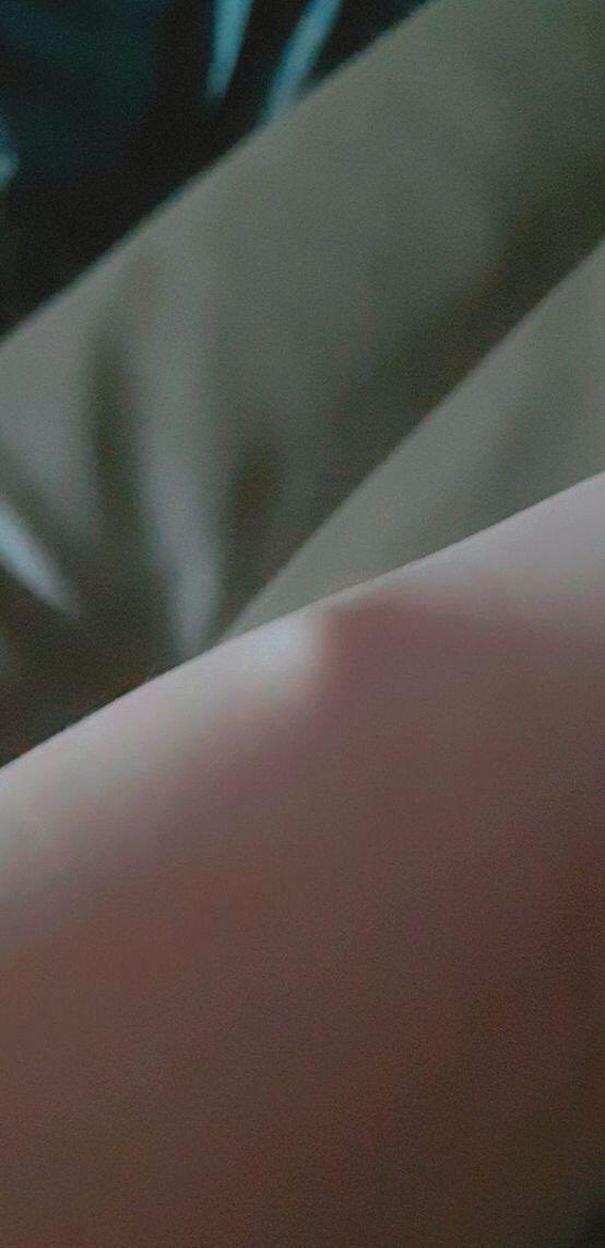 이것이 그 사진 손목보다는 살짝 아랜데 손목이 아니라기엔 애매하달까....