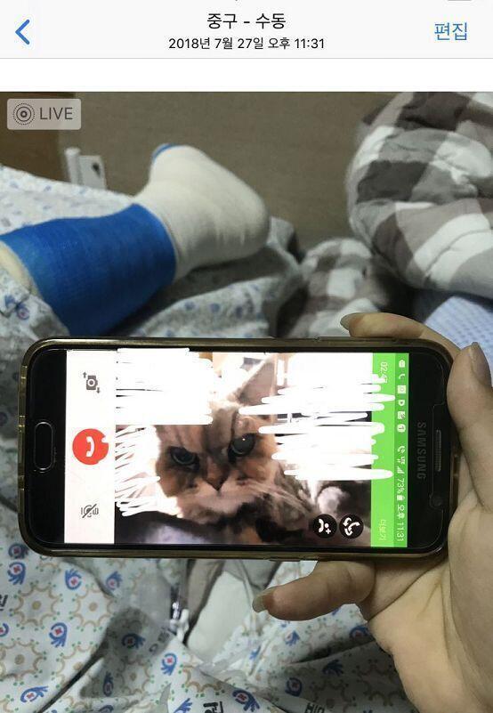 종종 주작이라고 의심받는 스레 본적 있어서 잠깐 인증할께 첫번째 사진은 1인실 있을때 두번째는 블로그에 수술 후기 올렸던 사진이야
