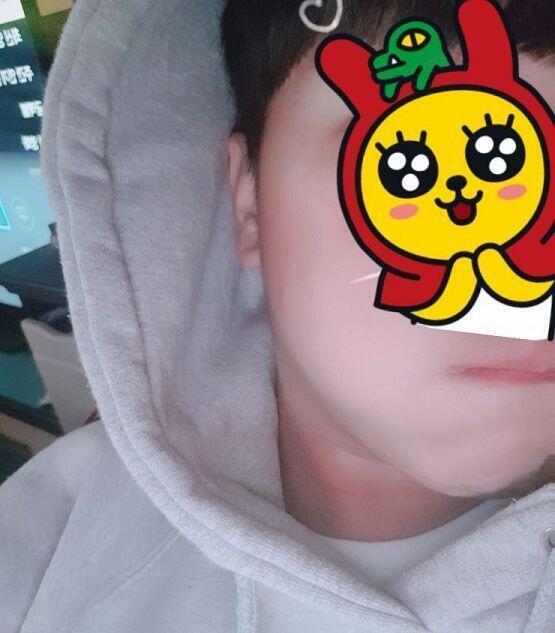 레주의 셀카놀이와 어깨위의 ㅅㅂ!