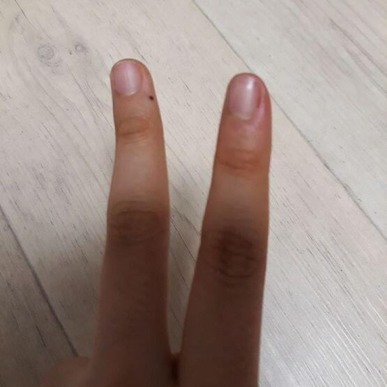 사진으로는 좀 덜해보이는데 실제로 엄청 시뻘개.....ㅜㅜ