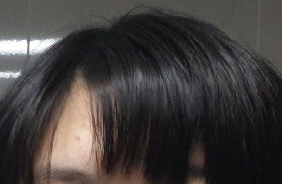 간만에 만나는 친구때문에 안하던 짓(머리세팅)하려가 망한 스레주의 앞머리... 조의를 눌러 x를 표하세요.....