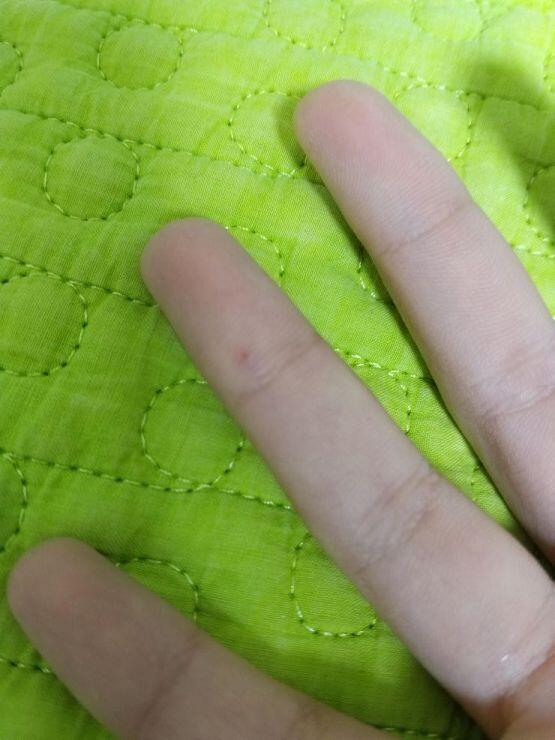 이거 자세히 보면 살갗이 까져있어 살짝 파여있다고 보면 돼...이거 뭔지 모르겠어 정말