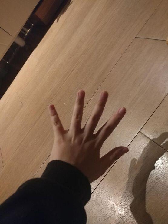 나 공기계루 찍었엉 나는 폰많이해서 그래진거같은데 왼손은 왼손으로 손가락들이 휘어져있구 오른쪽손가락들은 오른쪽으루 휘어져있어..