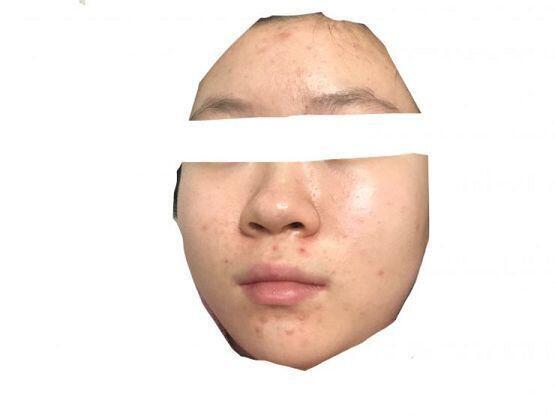 ㅌㅌㅋㅋㅋㅋㅋㅋㅅㅂㅌㅋ미안해얘들아,, 이정도면 많이 심한가?ㅠㅠ