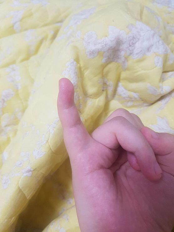 스레주의 새끼손가락ㅠㅠ