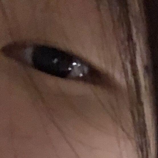 나도 원해.. 쌍꺼풀.. 예쁜 눈..