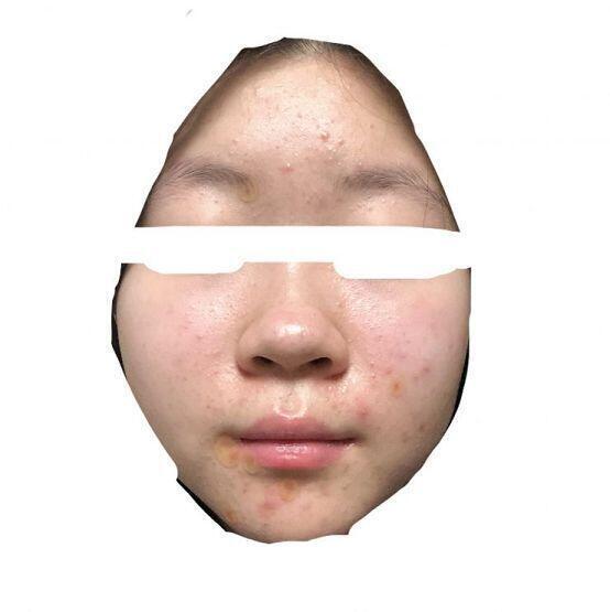 * 근접주의 * 혐짤주의
