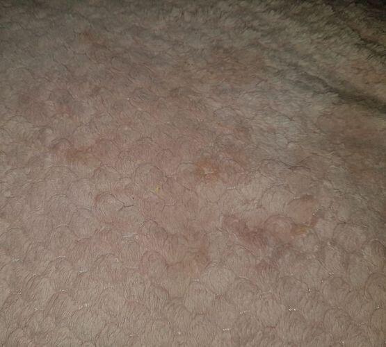 내가 저 베개를 3년정도 벴어 침도 흘려봐서 알겄지 근데 침흘리고 보면 하얗게 굳잖아 드라이로 안말려두 말라서 봤는데 저런색이야 내가 자다 내가