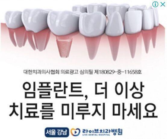임플란트 광고 자꾸 뜨냐 진짜 너무 괴롭다 않되를 본 문과생의 마음이 이런건가 나만 보기 너무 아깝다