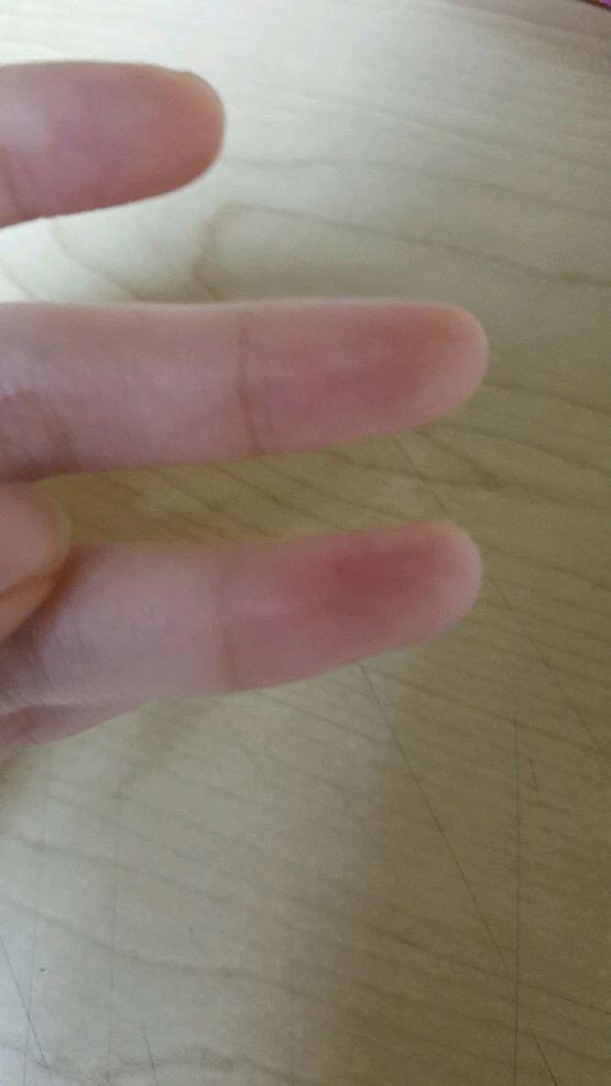 닦아냈구 없자나? 근데 또 이렇게생김ㅋㅋ