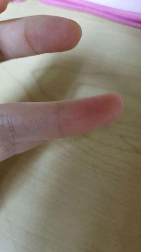닦아냈구 없자나? 근데 또 이렇게생김ㅋㅋ