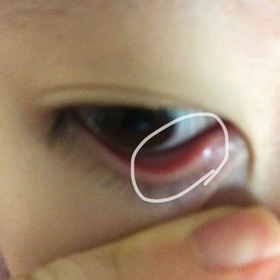 사진2는 눈 까뒤집은(?)거라 주의하고 봐줘!