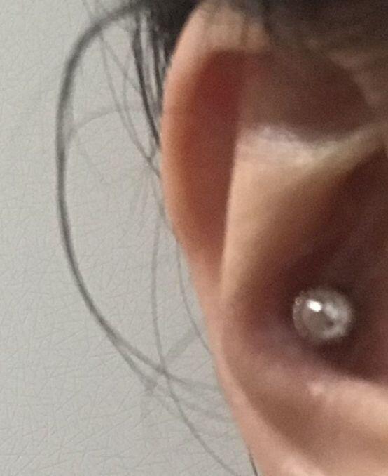 약간 시원한 느낌이 들면서 귀가 지금도 빨갛게 됐거든 ㅠㅠ 음.... 연골염 생겨서 수술했다는 분도 봐서 걱정된다ㅠ