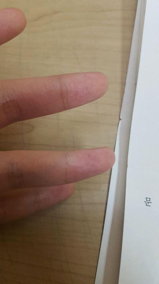 보일려나? 아직두 피가 고여?이써