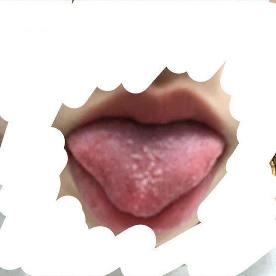 혀랑 입술빼고 하양색으로 도배해놔서 그런지 더 끔ㅈㅣㄱ해 사진보다 더심해 어떡하지