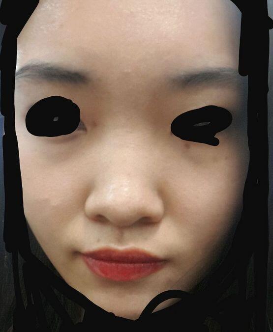 사진 혐이니깐 주의