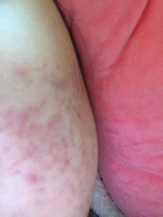 >>8 사진 첨부할게 혐오주의