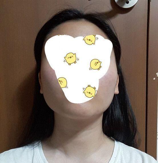 뭔가 정면 사진 괜찮아보여서 심각성을 보이기 위해 턱 들고 찍음