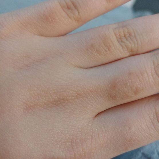 사진여기 ㅠㅠㅠㅜㅠ 안뽑는게 좋겠지..? 근데 털이 너무신경쓰여