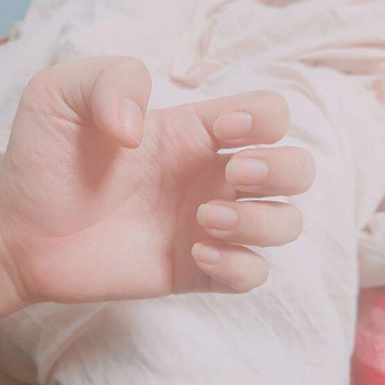 난 이정돈데 엄지손가락 손톱 부러져서 슬퍼하는데..윗스레들 대단