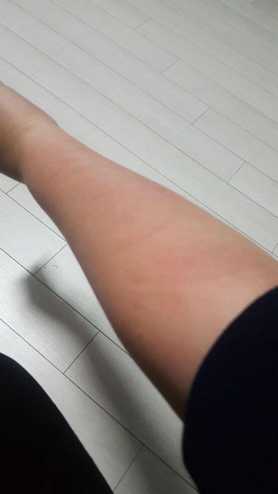 안녕! 난 스레주! 씨발새끼 컴 잠깐 비켜달라했는데 나한테 물병던져서 이지랄 만들어놈 ㅈㄴ아프당 ㅈ히발새끼 ....이게 애비냐? 나가뒤져라...
