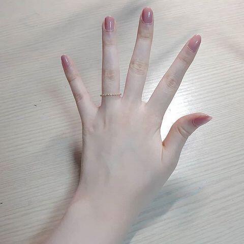 손 부운거는 약좀 바르니까 괜찮아졌어!