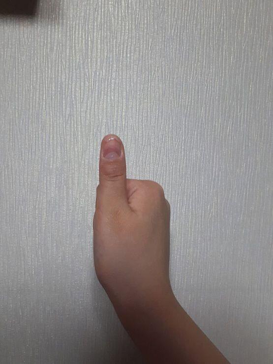 이건 4월 30일 1- 왼 손 2- 오른 손 3-오른 손 엄지 솔직히 이거 시작한 계기가 오른 손 엄지 때문일지도 몰라ㅋㅋ 내가 손톱 울퉁불퉁