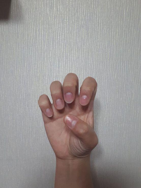 5월 8일 1- 왼 손 2- 오른 손 하드너를 지워서 더 못나 보일 수 있엉ㅠ 아직 안 물어뜯고 버티고 있어!