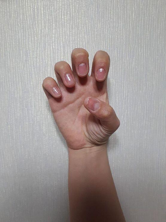 이건 4월 30일 1- 왼 손 2- 오른 손 3-오른 손 엄지 솔직히 이거 시작한 계기가 오른 손 엄지 때문일지도 몰라ㅋㅋ 내가 손톱 울퉁불퉁