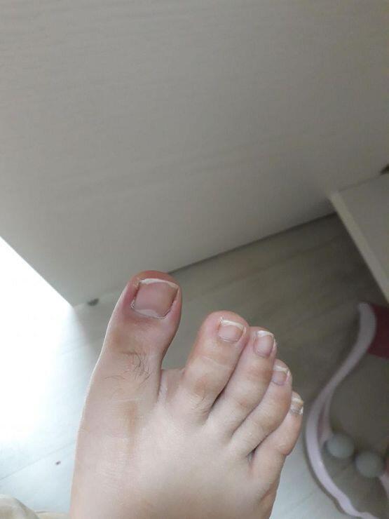 엄지발가락이야(약혐주의)