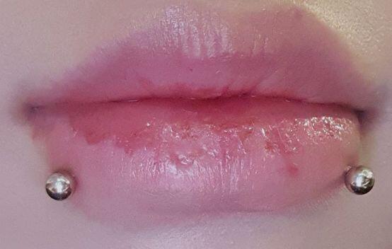 예쁘다해서 자신감 붙었음 하나 더 올렸다 어제 저녁에 뚫었는데 잠버릇이 심해서 그런가 소염제 먹었는데도 부었어 안그래도 입술 순댄데 ㅋㅋ