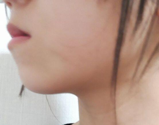 나 턱이 윗턱보다 아래턱이 더 튀어나왓고든...