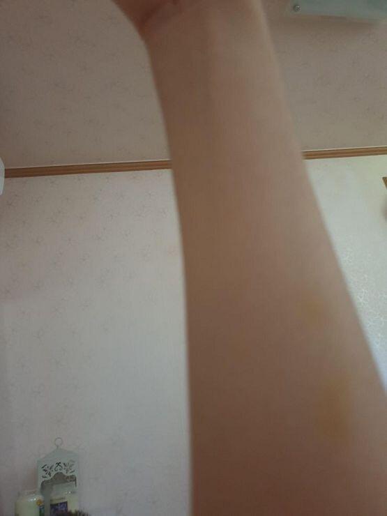 시간이 갈수록 점점 가까워지고 점점 깨어나지못하고 멍이 더 들기 시작했어 참고로 나는 주택근무라 집밖에도 안나가 인증샷 남길게