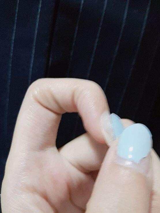 사실 반쯤 뜯기 시작함... 하... 안 넘어져서 딱지 뗄만한 것도 없고 확 떼버리고 싶은 충동이 근질근질