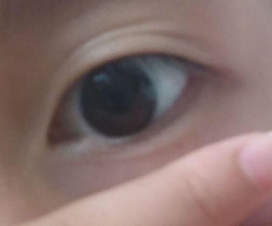 참고로 나 예전엔 쌍커풀있옸음